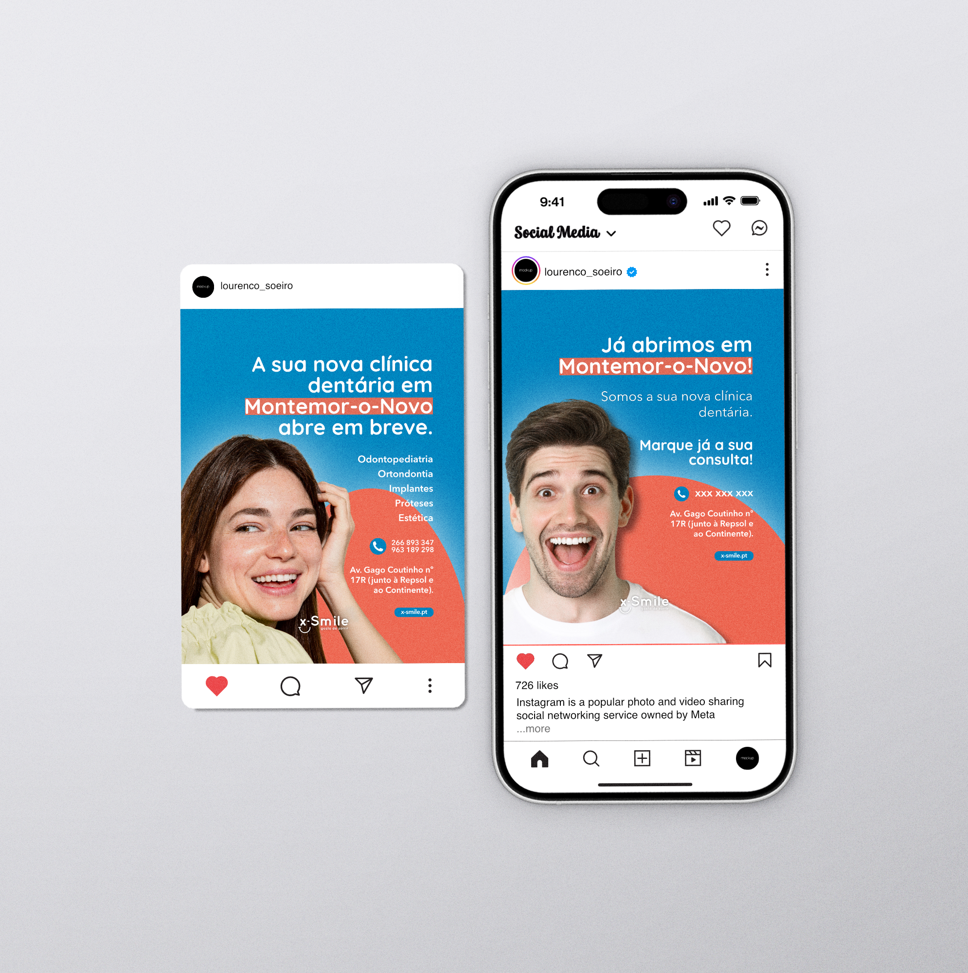 x-Smile Informational Flyer